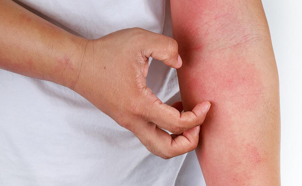 kemungkinan komplikasi daripada menggunakan soda