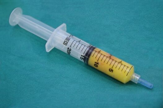 Picagari dengan tisu adiposa untuk lipofilling